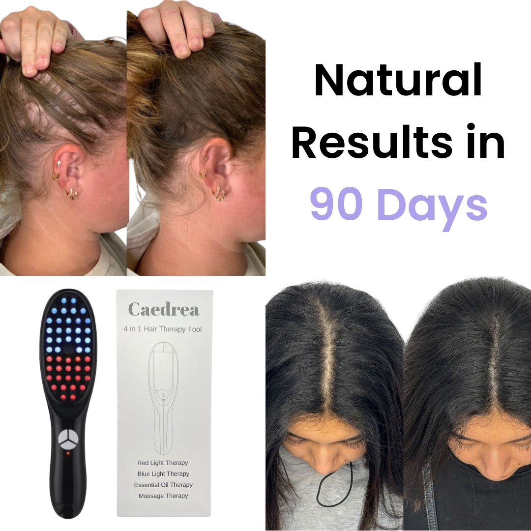 Thera Brush — Ignite Dormant Follicles for Fuller, Thicker Hair You’ll Flaunt with Pride