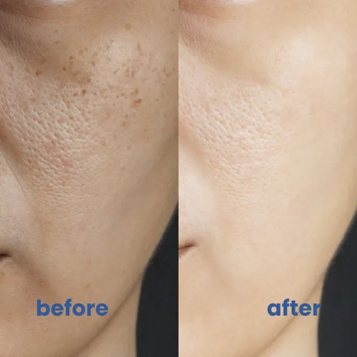 RadianceLift™ — Unleash Your Naturally Radiant, Flawless Glow Every Day