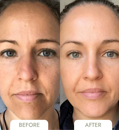 SkinGuard Pro — Instantly Lift, Hydrate, and Reveal Youthful Radiance