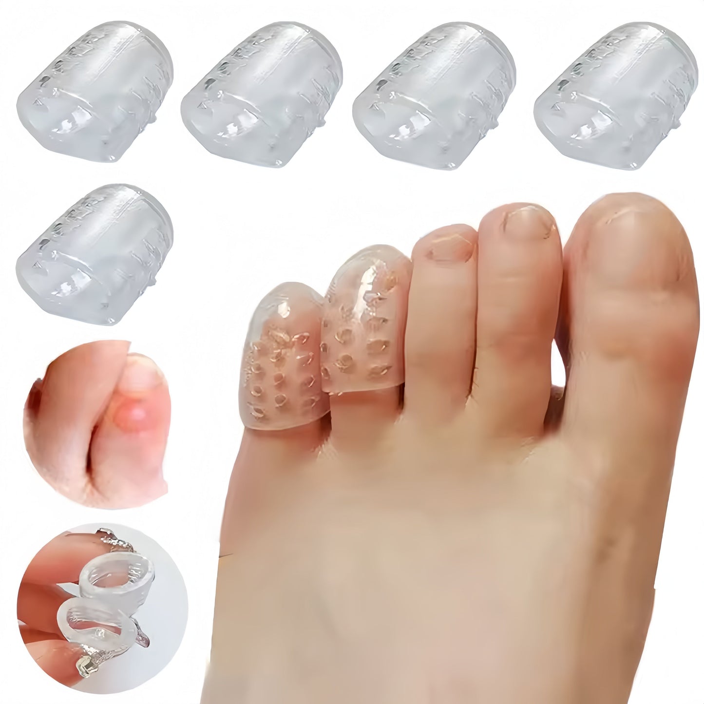 Silicone Toe Shield — Step Pain-Free and Reclaim Your Freedom