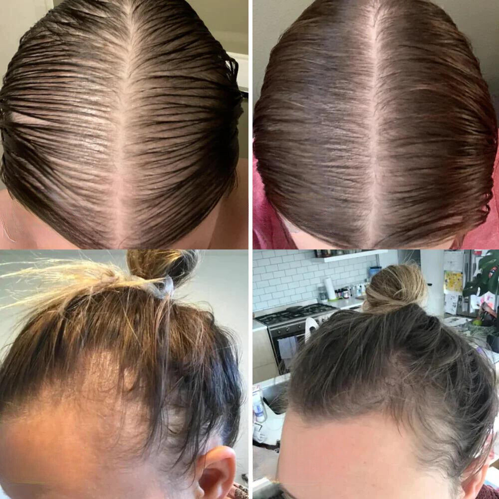 VitaFolliX™ — Unleash Fierce, Full-Bodied Hair That Commands Every Room (1+1 Free)