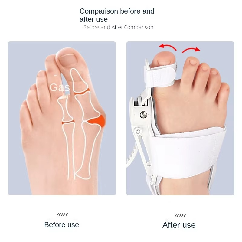 StrideRight — Break Free from Bunion Pain and Step into Comfort All Day