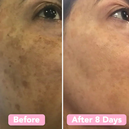 LuminaBright™ Turmeric & Kojic Acid Pads — Reveal Your Radiant, Spotless Glow That Turns Every Head