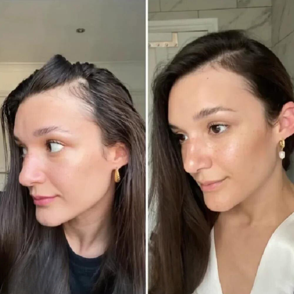 VitaFolliX™ — Unleash Fierce, Full-Bodied Hair That Commands Every Room (1+1 Free)