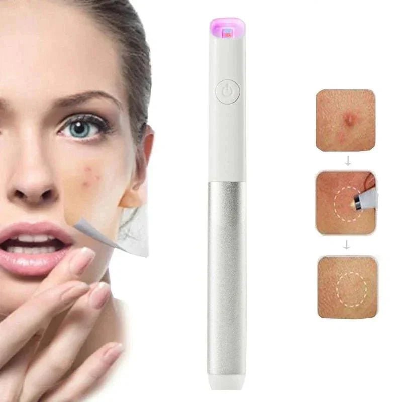 ClearSkinX — Destroy Acne Pain-Free and Reveal Radiant Confidence Fast