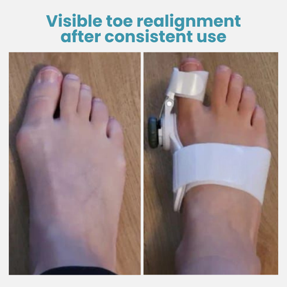 StrideRight — Break Free from Bunion Pain and Step into Comfort All Day