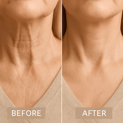 Defy Time — Snap Back Sagging Skin and Flaunt a Jaw-Dropping Neckline Instantly