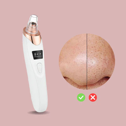 Nano Electrical Vacuum Blackhead Remover — Effortless, Pain-Free Power for Skin That Glows Confidently