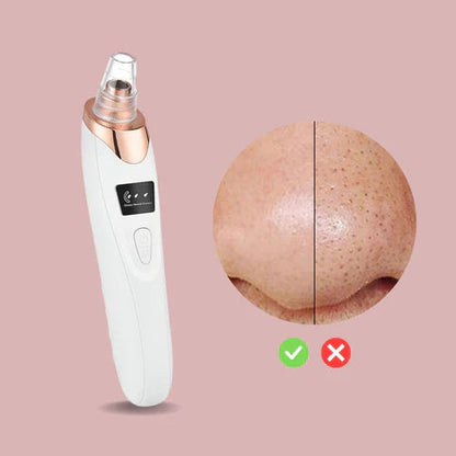 Nano Electrical Vacuum Blackhead Remover — Effortless, Pain-Free Power for Skin That Glows Confidently
