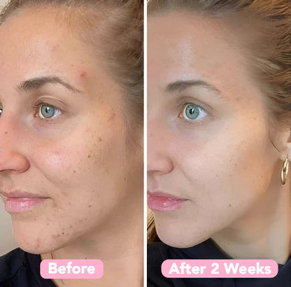 LuminaBright™ Turmeric & Kojic Acid Pads — Reveal Your Radiant, Spotless Glow That Turns Every Head