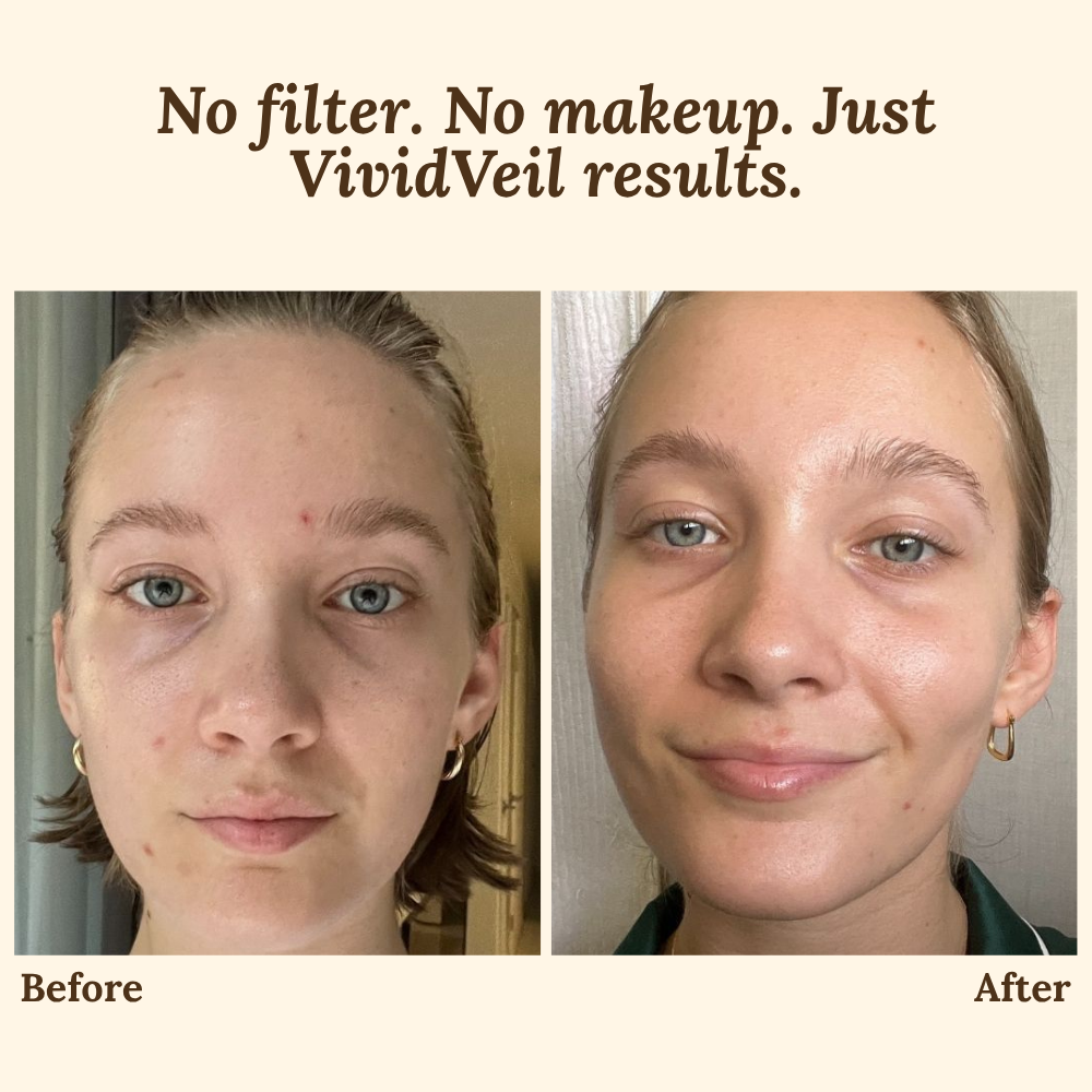 SkinGuard Pro — Instantly Lift, Hydrate, and Reveal Youthful Radiance