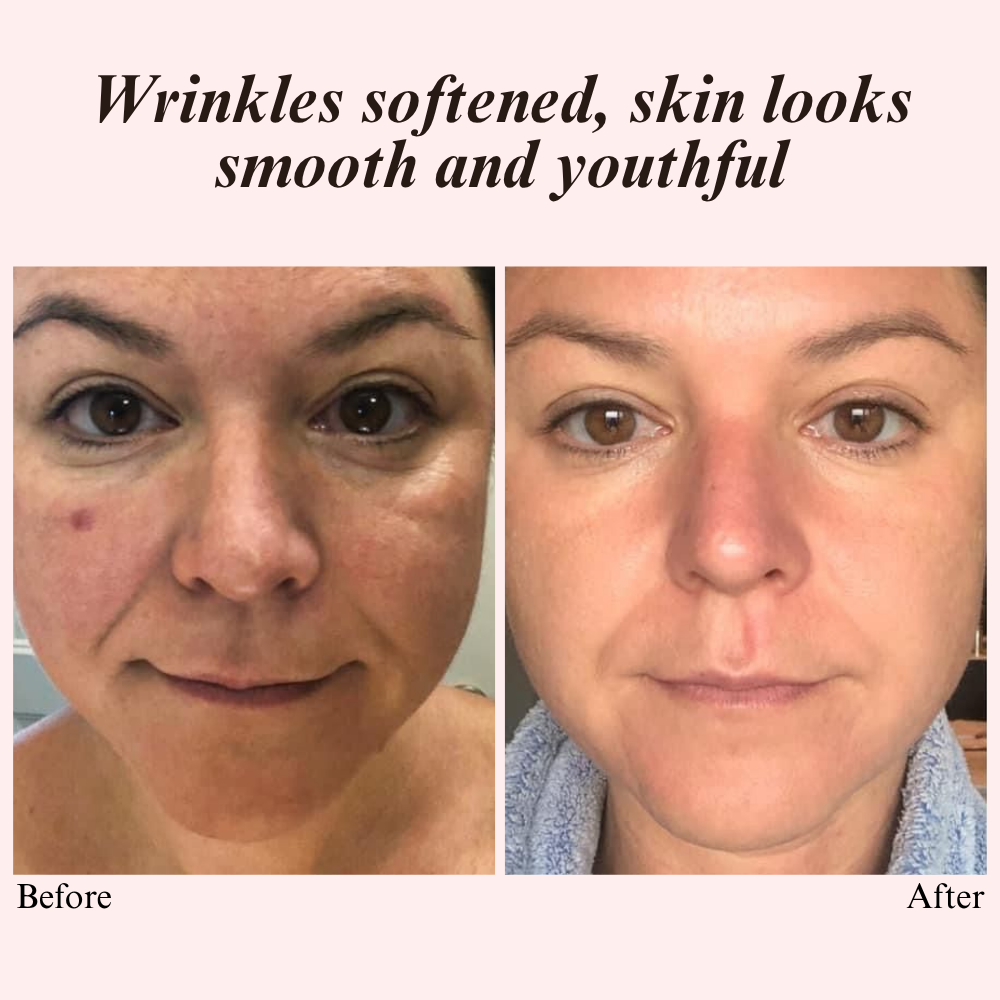 VelvetVeil Concealer — Transform Your Skin, Unleash Flawless Confidence All Day