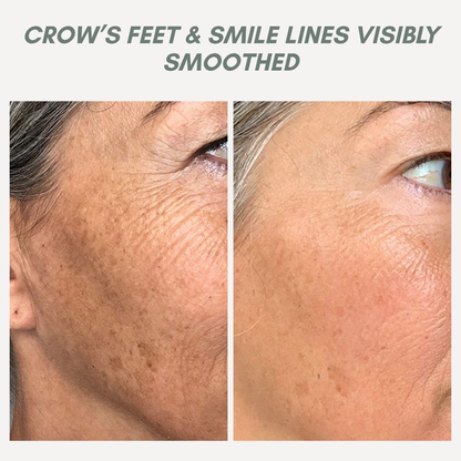 GlamLiftX — Instantly Reclaim Youthful Confidence and Erase Years from Your Face