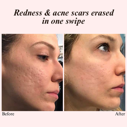 VelvetVeil Concealer — Transform Your Skin, Unleash Flawless Confidence All Day