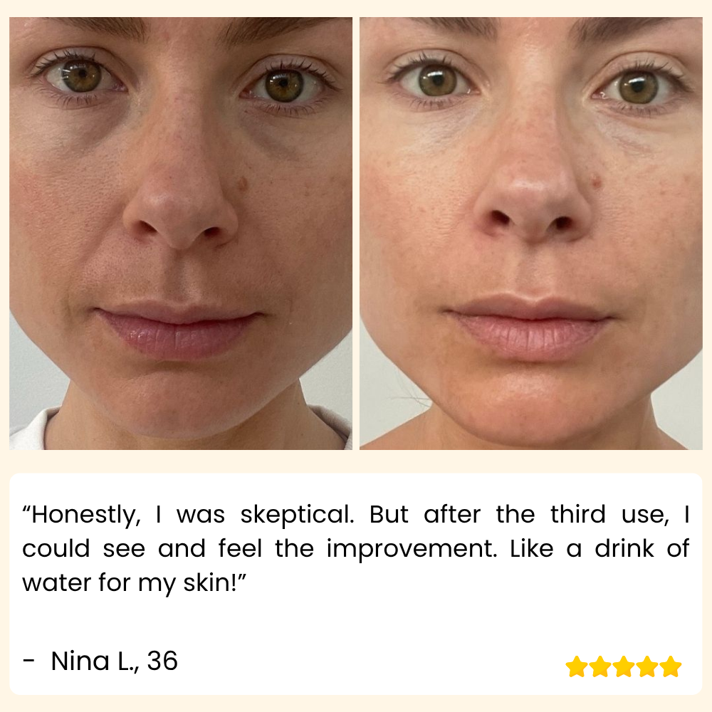 SkinGuard Pro — Instantly Lift, Hydrate, and Reveal Youthful Radiance