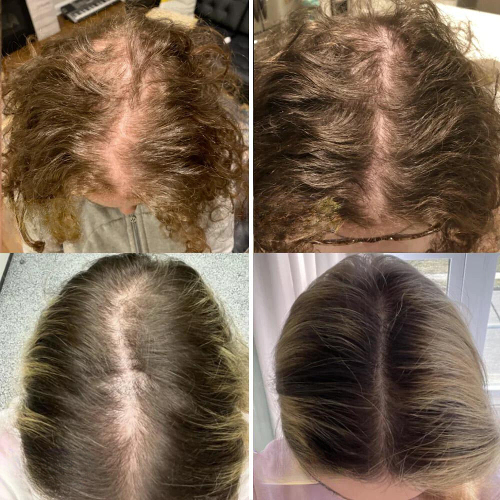 VitaFolliX™ — Unleash Fierce, Full-Bodied Hair That Commands Every Room (1+1 Free)