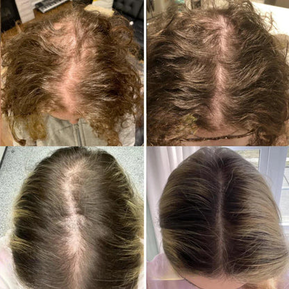 VitaFolliX™ — Unleash Fierce, Full-Bodied Hair That Commands Every Room (1+1 Free)