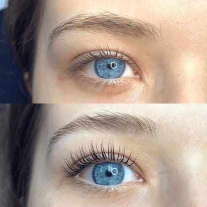 VityLash™ — Amplify Your Gaze with Lasting, Damage-Free Lash Lifts