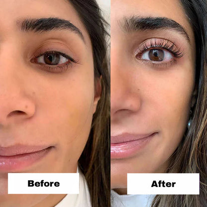 VityLash™ — Amplify Your Gaze with Lasting, Damage-Free Lash Lifts