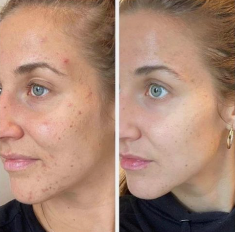 Luminara Serum — Ignite a Radiant, Youthful Glow That Stops Time (1+1 free)