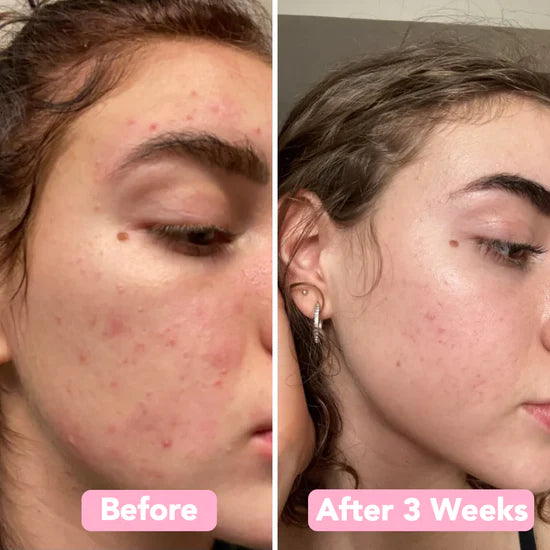 GlowVita — Reveal Youthful Radiance and Banish Dark Spots Fast (40 pieces)