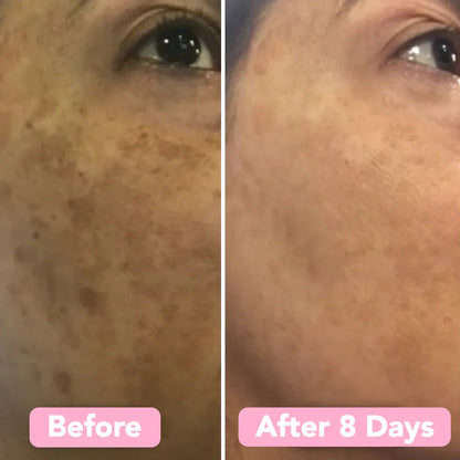 GlowVita — Reveal Youthful Radiance and Banish Dark Spots Fast (40 pieces)