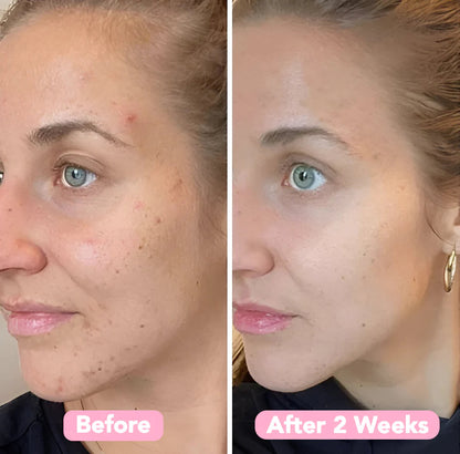 GlowVita — Reveal Youthful Radiance and Banish Dark Spots Fast (40 pieces)