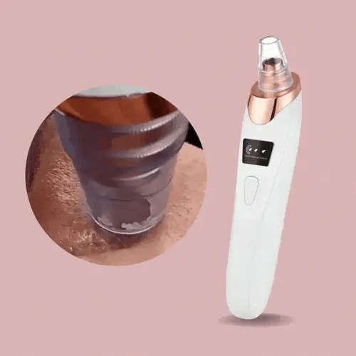 Nano Electrical Vacuum Blackhead Remover — Effortless, Pain-Free Power for Skin That Glows Confidently