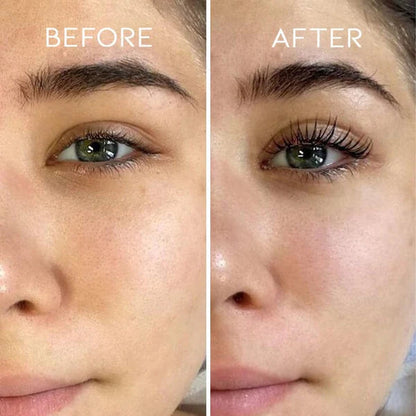 VityLash™ — Amplify Your Gaze with Lasting, Damage-Free Lash Lifts