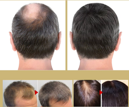 BlazeRoot™ — Ignite Deep Growth and Bring Your Hair Back to Life