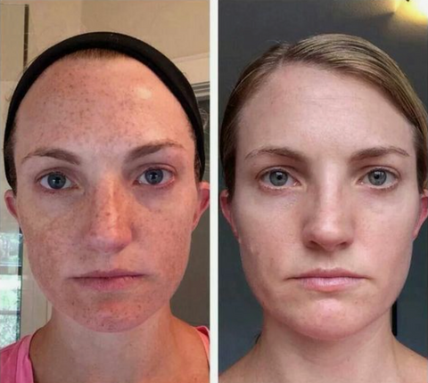 Luminara Serum — Ignite a Radiant, Youthful Glow That Stops Time (1+1 free)