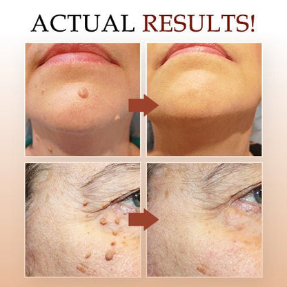 ClearQuik™ — Erase Skin Spots Fast and Reveal Your True Confidence