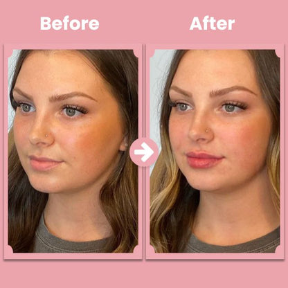 Lip Revival Roller — Ignite Natural, Effortless Fullness That Turns Heads Instantly